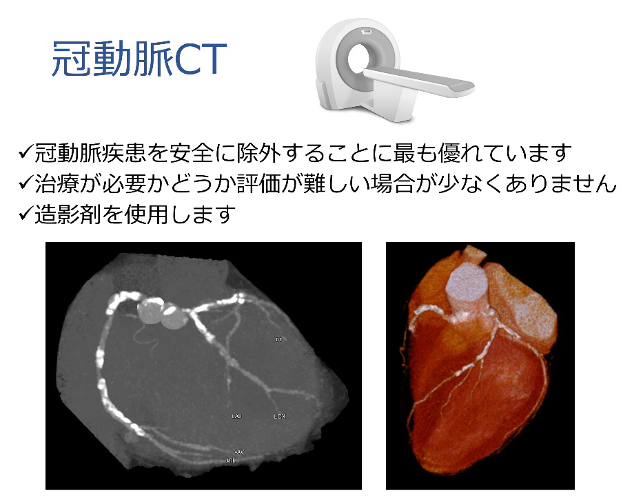 冠動脈疾患を安全に除外することに最も優れています。治療が必要かどうか評価が難しい場合が少なくありません。造影剤を使用します。